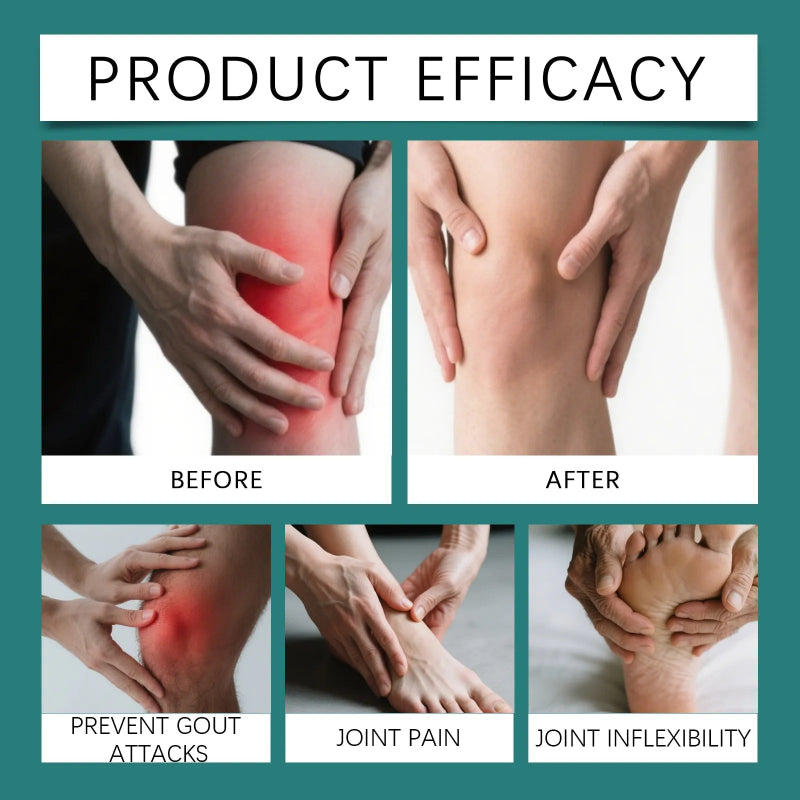 🌿 South Moon Gout Ease Relief Spray 🌿 ( BUY 1 GET 1 FREE )