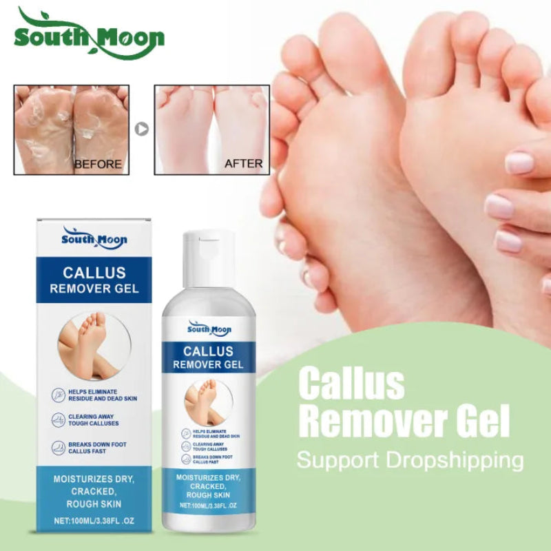 ✨ South Moon Foot Callus Remover Gel ✨ ( BUY 1 GET 1 FREE )