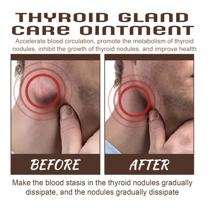 South Moon Thyroid Gland Ointment Cream ( BUY 1 GET 1 FREE )