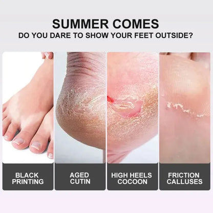 EXFOLIATING FOOT PEEL MASK ( BUY 1 GET 1 FREE )