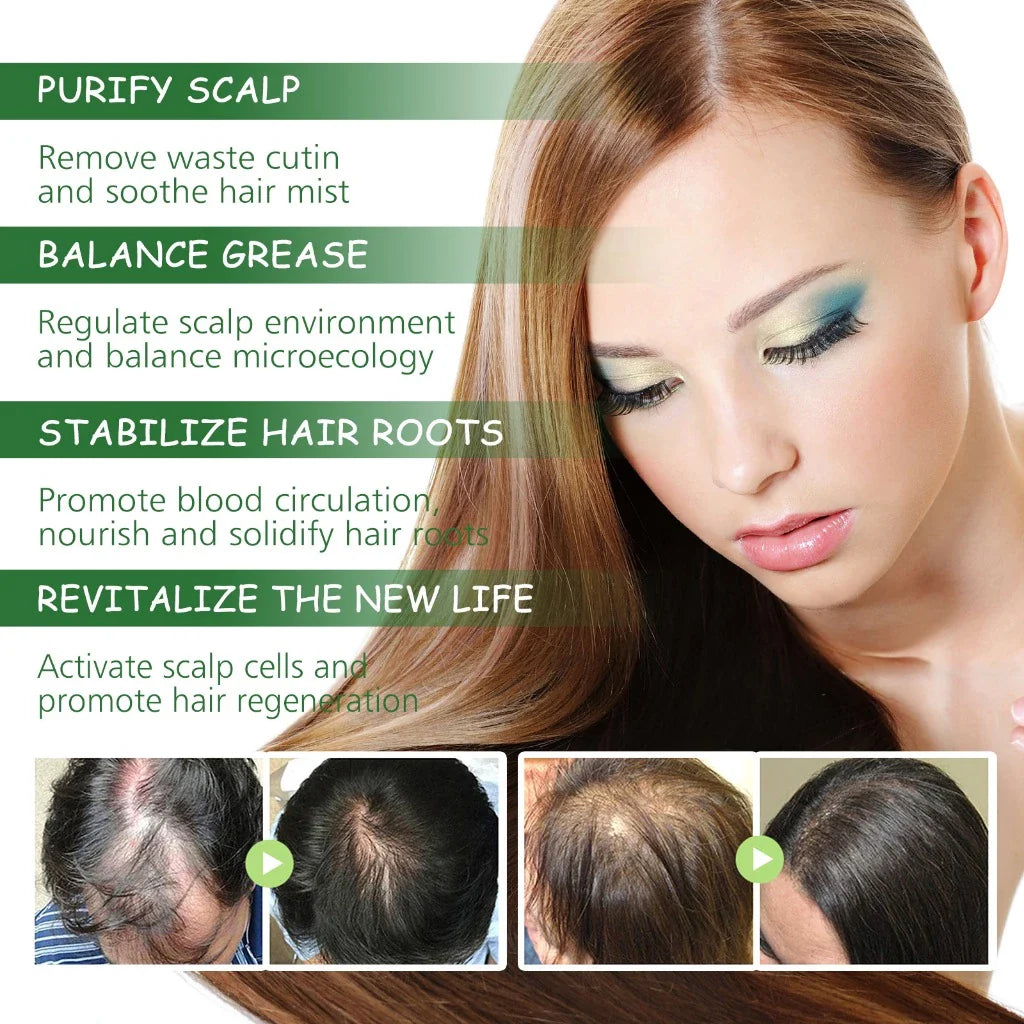 Rosemary Hair , Skin & body  Essentiall Oil  ( BUY 1 GET 1 FREE )