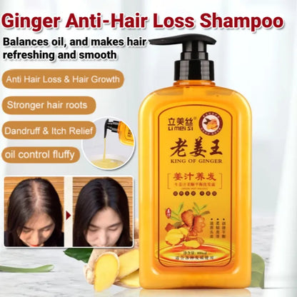 King Of Ginger Anti-Hair Loss Shampoo ( BUY 1 GET 1 FREE )