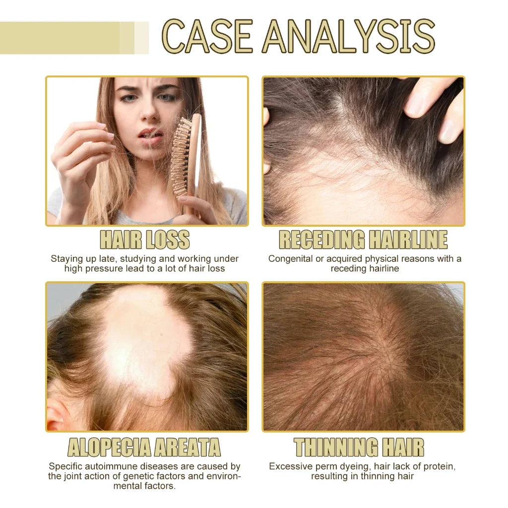Imported Rosemary Hair Growth Oil ( BUY 1 GET 1 FREE )